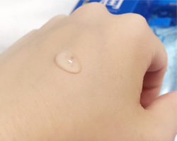 皮膚アレルギー検査